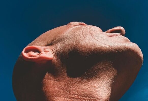 mâchoire plus carrée