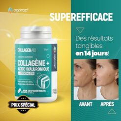 Collagene et acide hyaluronique Collagene 120 comprimes, Articulations Fortes et Peau Hydratée. Collagène, Acide Hyaluronique, Coenzyme q10. Cure de 2 mois. Collagene pour Articulation et Ongles